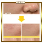 سرم قابض منافذ تیام