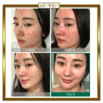 تونر لایه بردار و ضدجوش میراکل سام بای می