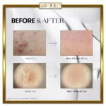 سرم میکرونیدلینگ ریدل شات VT COSMETICS